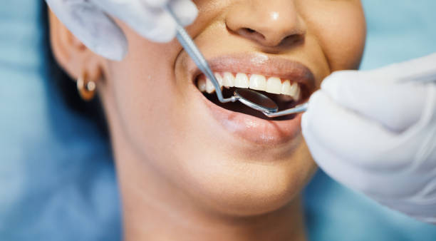 Best Root Canal Emergency Dentist  in Oakley, KS
